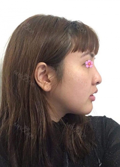 View Plastic Surgery, Reviews, Images, Promotions — Korea cost, reviews & before-after | MISOODA