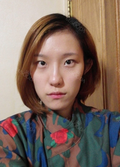 ts plastic surgery — Korea cost, reviews & before-after | MISOODA