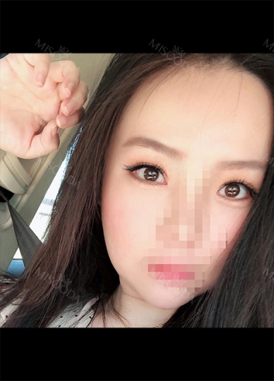 Hyundai Aesthetics, Reviews, Images, Promotions — Korea cost, reviews & before-after | MISOODA