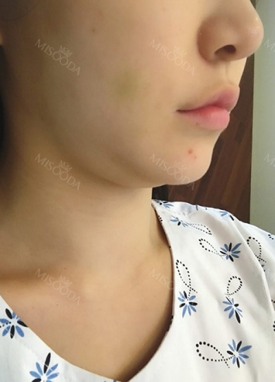 THE TIME Plastic Surgery & Dermatology — Korea cost, reviews & before-after | MISOODA