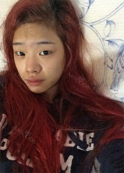 TOP FACE Plastic Surgery,Reviews,Images, Promotions — Korea cost, reviews & before-after | MISOODA