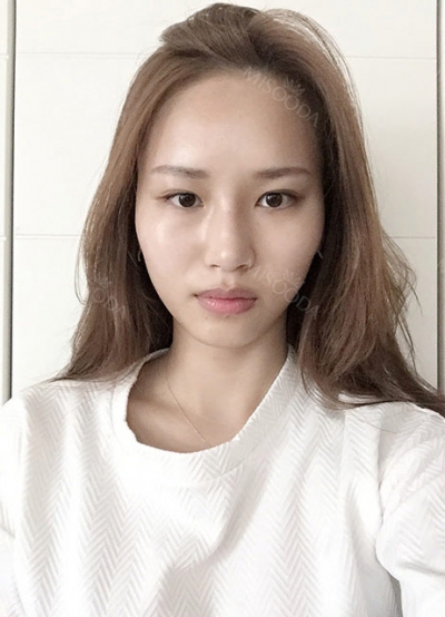 TOP FACE Plastic Surgery,Reviews,Images, Promotions — Korea cost, reviews & before-after | MISOODA