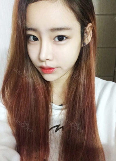 TOP FACE Plastic Surgery,Reviews,Images, Promotions — Korea cost, reviews & before-after | MISOODA