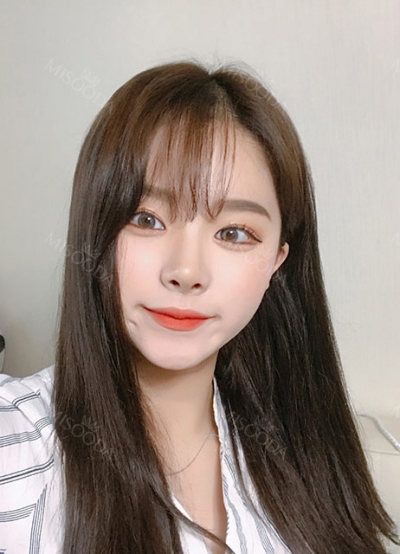 ts plastic surgery — Korea cost, reviews & before-after | MISOODA