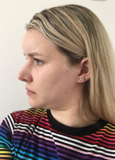 THE TIME Plastic Surgery & Dermatology — Korea cost, reviews & before-after | MISOODA
