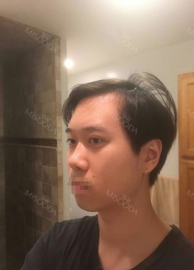 Banobagi Plastic Surgery,Reviews,Images, Promotions, MISOODA — Korea cost, reviews & before-after | MISOODA