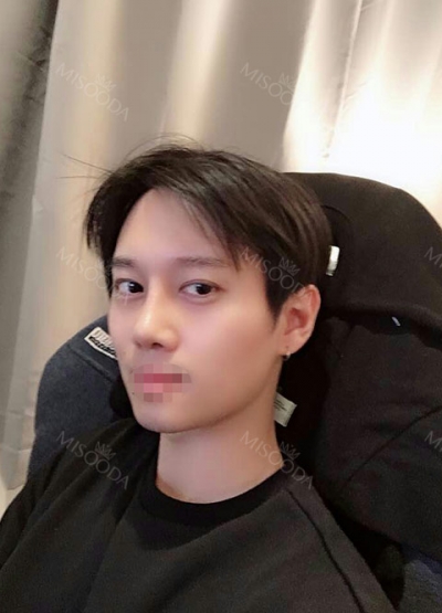 Banobagi Plastic Surgery,Reviews,Images, Promotions, MISOODA — Korea cost, reviews & before-after | MISOODA