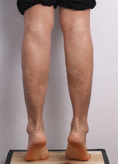 Ruby Plastic Surgery, Reviews, Images, Promotions — Korea cost, reviews & before-after | MISOODA