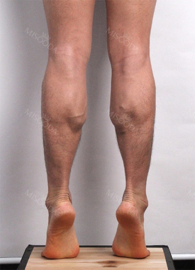 Ruby Plastic Surgery, Reviews, Images, Promotions — Korea cost, reviews & before-after | MISOODA