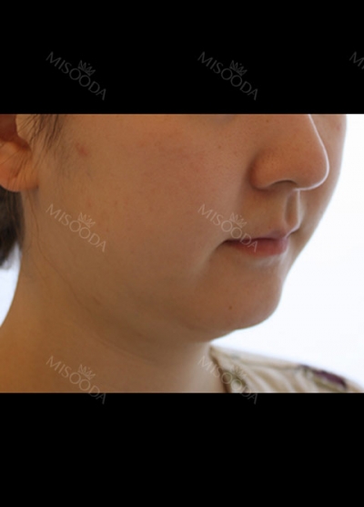 THE TIME Plastic Surgery & Dermatology — Korea cost, reviews & before-after | MISOODA