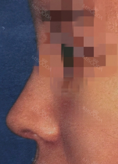 TOP FACE Plastic Surgery,Reviews,Images, Promotions — Korea cost, reviews & before-after | MISOODA