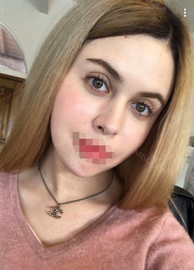 THE TIME Plastic Surgery & Dermatology — Korea cost, reviews & before-after | MISOODA