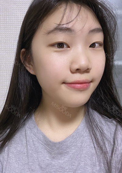 Ruby Plastic Surgery, Reviews, Images, Promotions — Korea cost, reviews & before-after | MISOODA