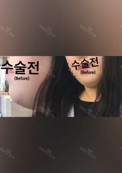 THE TIME Plastic Surgery & Dermatology — Korea cost, reviews & before-after | MISOODA