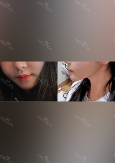 THE TIME Plastic Surgery & Dermatology — Korea cost, reviews & before-after | MISOODA
