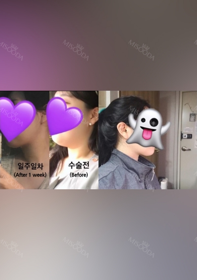 THE TIME Plastic Surgery & Dermatology — Korea cost, reviews & before-after | MISOODA