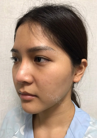 GIRIN Plastic Surgery. GIRIN aesthetic Clinic — Korea cost, reviews & before-after | MISOODA