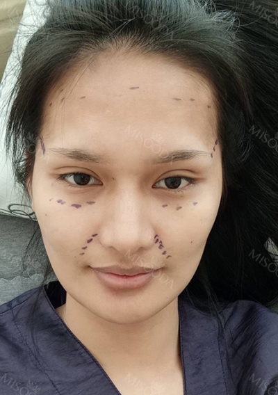 GIRIN Plastic Surgery. GIRIN aesthetic Clinic — Korea cost, reviews & before-after | MISOODA