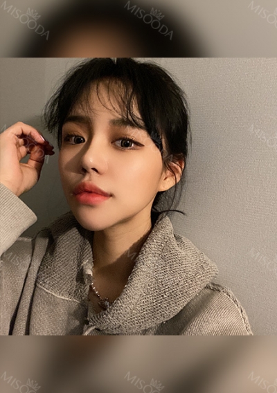 kyunam han, jonglim park, junho choi, banobagi, 345ps, 345plasticsurgery, gangnam plastic surgery, Dr.han, Dr.Park, korea plastic surgery, bone contour surgery, cheekbone surgery, V-line, nose surgery, Asian nose, breast surgery, face lifting, thread — Korea cost, reviews & before-after | MISOODA