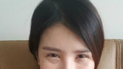 Dream Plastic Surgery, Reviews, Images, Promotions — Korea cost, reviews & before-after | MISOODA